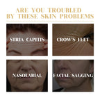 Collagen Boost Multi-Pack (10 PCS) – Intensive Anti-Wrinkle & Firming Ritual